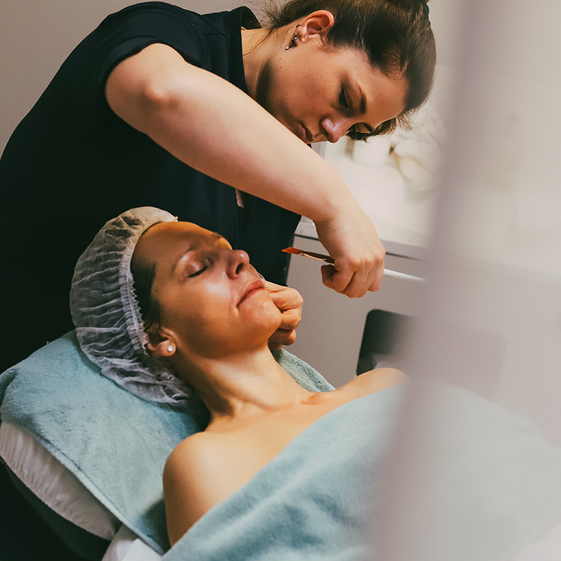 behandeling-mesoéclat-peeling