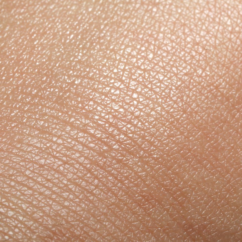 huidprobleem-doffe-huid